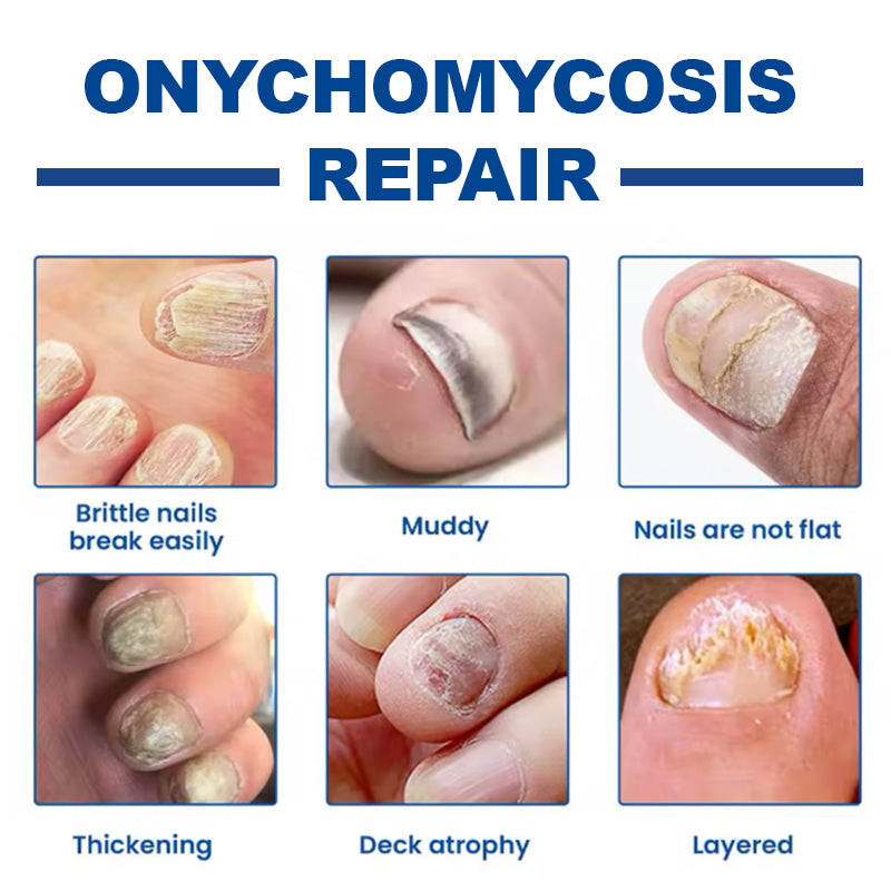 Fungal Nail Repair Patches (60 Patches)