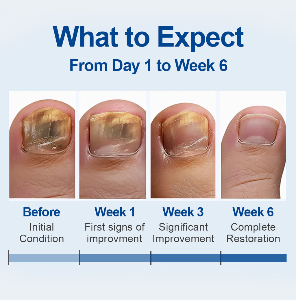 Fungal Nail Repair Patches (60 Patches)